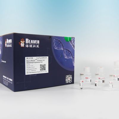 22203 immunoprecipitazione Kit With Flexible Simple Operation della proteina A/G