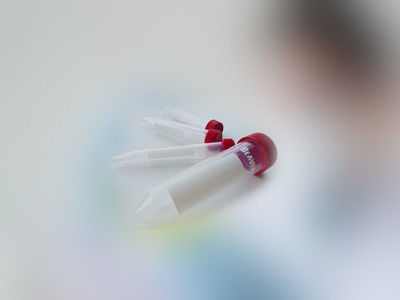 i materiali di consumo inferiori conici del laboratorio medico dei tubi centrifughi 15mL ammassano sterile